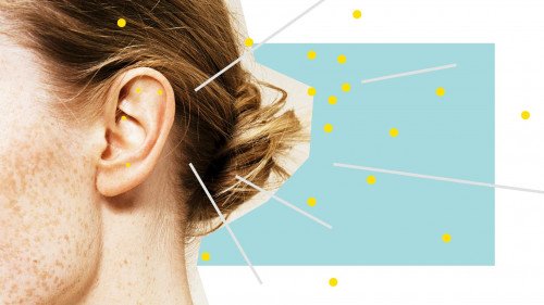 Иглоукалывание ушей - это последняя тенденция в отношении здоровья в Великобритании, но действительно ли это работает?